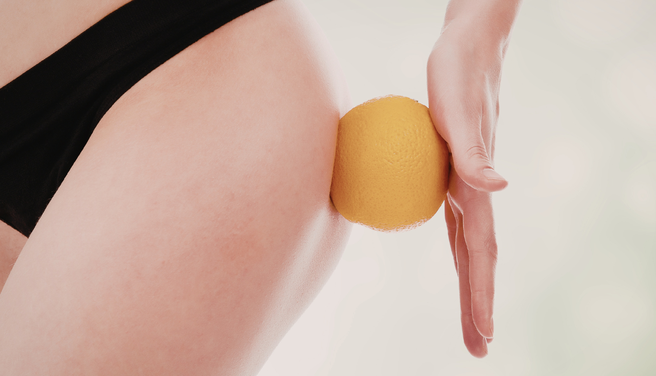 Cellulite: cosa c’è davvero sotto la pelle e cosa può fare la differenza