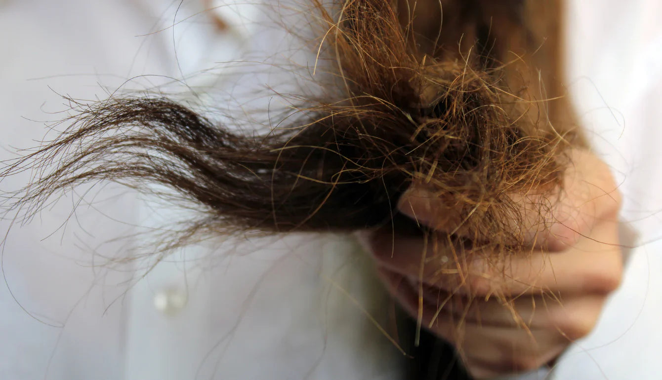 Capelli e unghie fragili: le carenze nutrizionali più comuni
