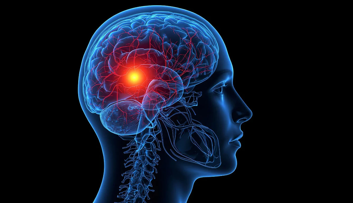 Ictus: i segnali da riconoscere e perché ogni minuto conta